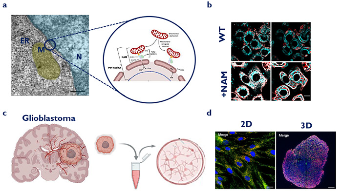 Transmission Electron Micrograph of the Nucleus Associated Mitochondria  Transmission Electron Micrograph of the Nucleus Associated Mitochondria