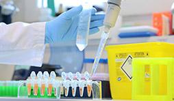 Illustration prélèvement