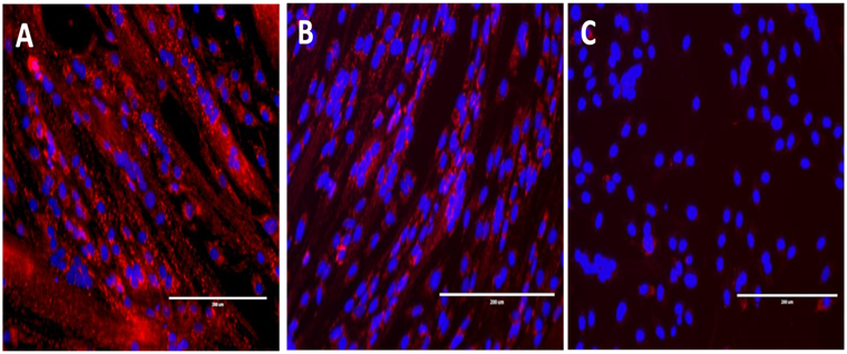 Inhibition de la différenciation des cellules musculaires par co-culture indirecte (système Transwell) avec des cellules malignes de carcinomes ORL.  Inhibition de la différenciation des cellules musculaires par co-culture indirecte (système Transwell) avec des cellules malignes de carcinomes ORL.